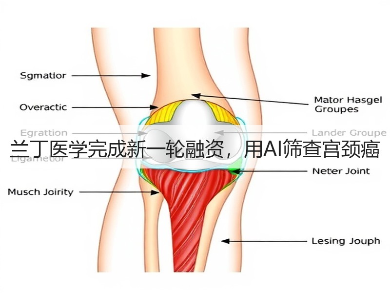 兰丁医学完成新一轮融资，用AI筛查宫颈癌