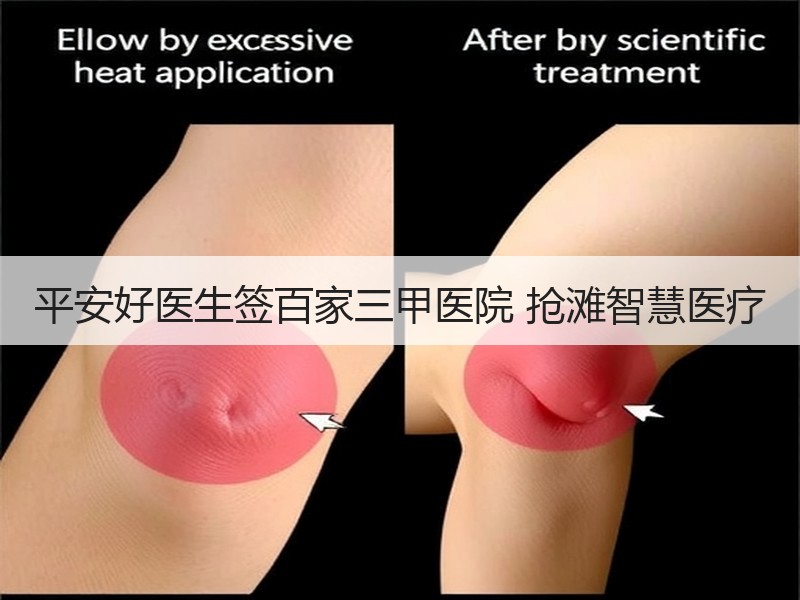 平安好医生签百家三甲医院 抢滩智慧医疗