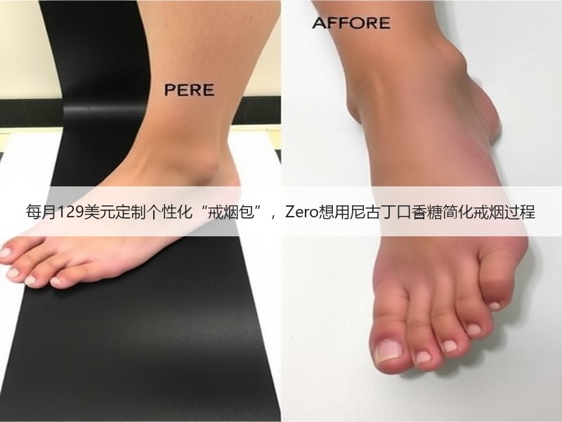 每月129美元定制个性化“戒烟包”，Zero想用尼古丁口香糖简化戒烟过程