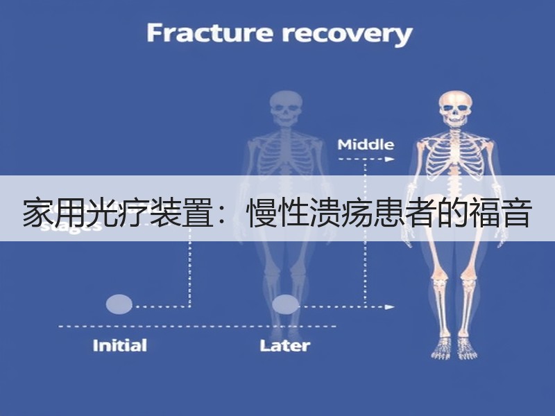 家用光疗装置：慢性溃疡患者的福音