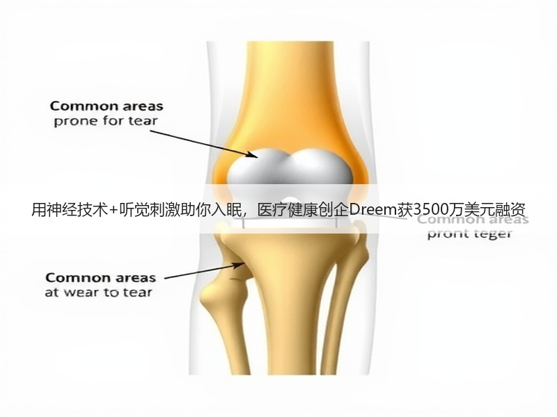 用神经技术+听觉刺激助你入眠，医疗健康创企Dreem获3500万美元融资