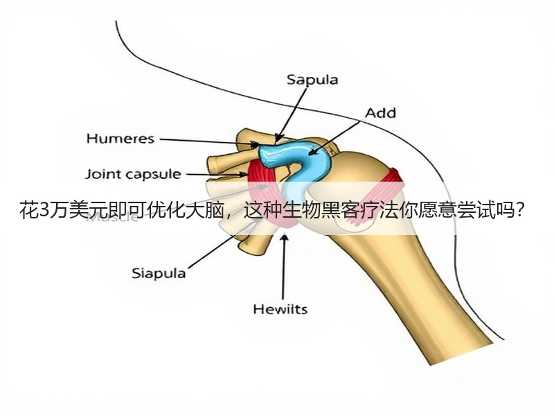 花3万美元即可优化大脑，这种生物黑客疗法你愿意尝试吗？