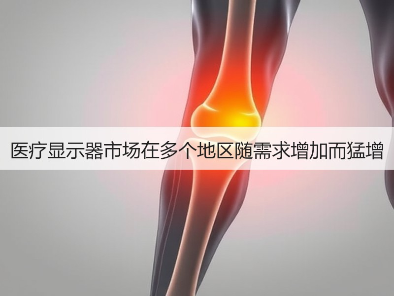医疗显示器市场在多个地区随需求增加而猛增