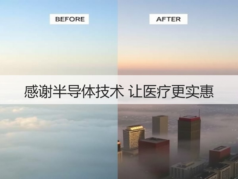 感谢半导体技术 让医疗更实惠