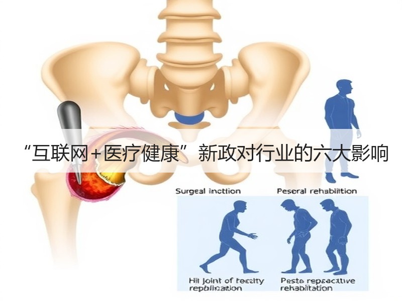 “互联网+医疗健康”新政对行业的六大影响