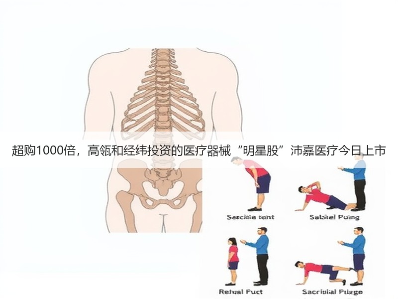 超购1000倍，高瓴和经纬投资的医疗器械“明星股”沛嘉医疗今日上市