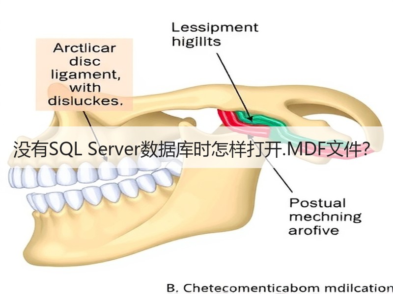 没有SQL Server数据库时怎样打开.MDF文件？